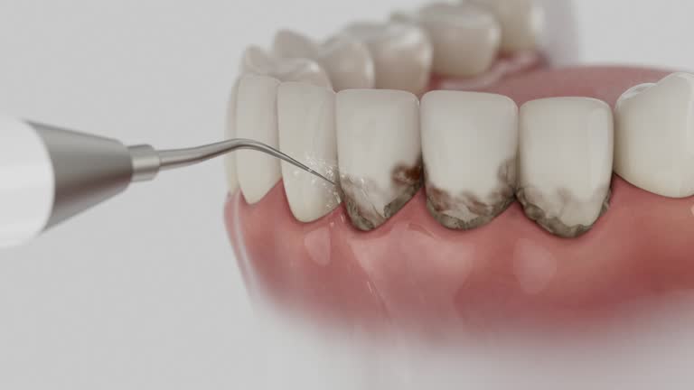 Trusted Invisalign Clear Aligners service in Winnfield, LA - Dentist Open Now